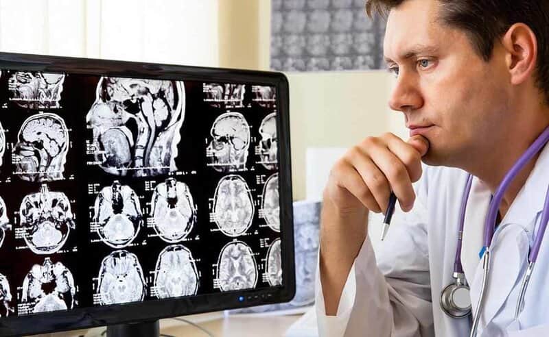 درمان سردرد توسط متخصص مغز و اعصاب - چیکاو