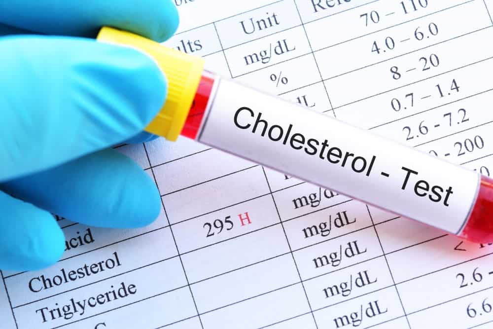 آزمایش خون برای تشخیص میزان کلسترول