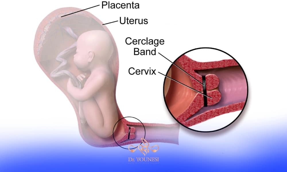 A diagram of a baby in the womb