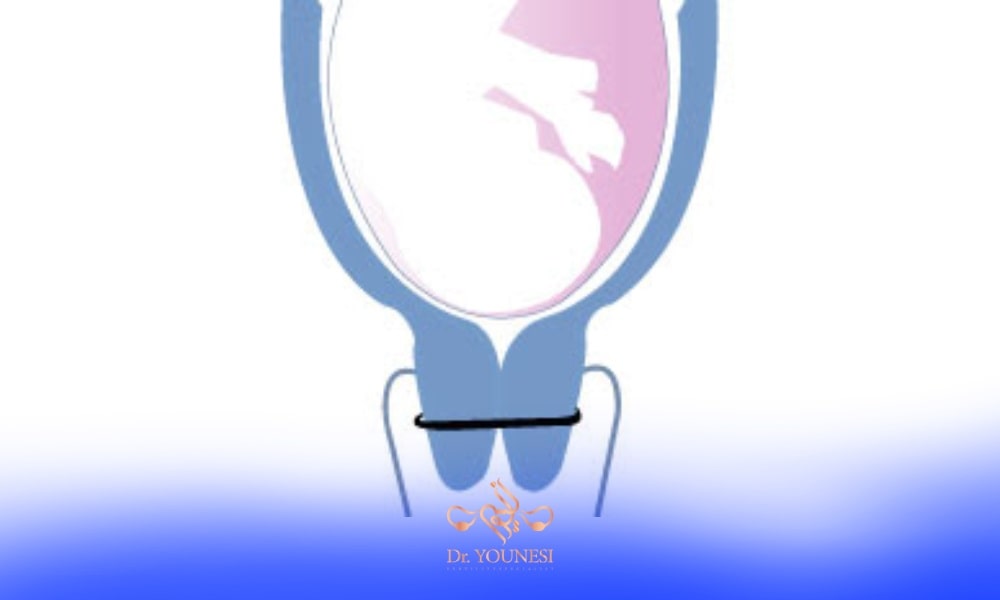 A blue and white illustration of a uterus