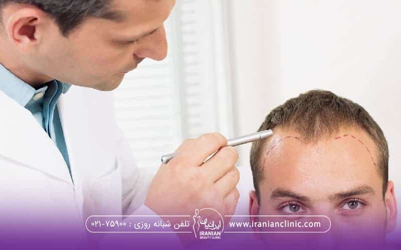 مردی که به رو به رو نگاه میکند و دکتری که در حال بررسی و علامت گذاری روی خط رویش فرد است